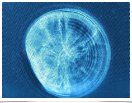Sagitta otolith of a 18-day old laboratory-reared sprat larva. 12 increments are visible (1,000x magnification w/phase contrast)