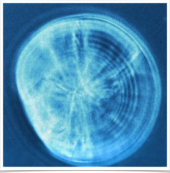 Sagitta otolith of a 18-day old laboratory-reared sprat larva. 12 increments are visible (1,000x magnification w/phase contrast)