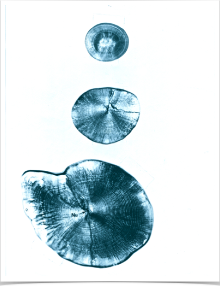Sagittal otoliths of juvenile sprats showing daily increments - various ages.