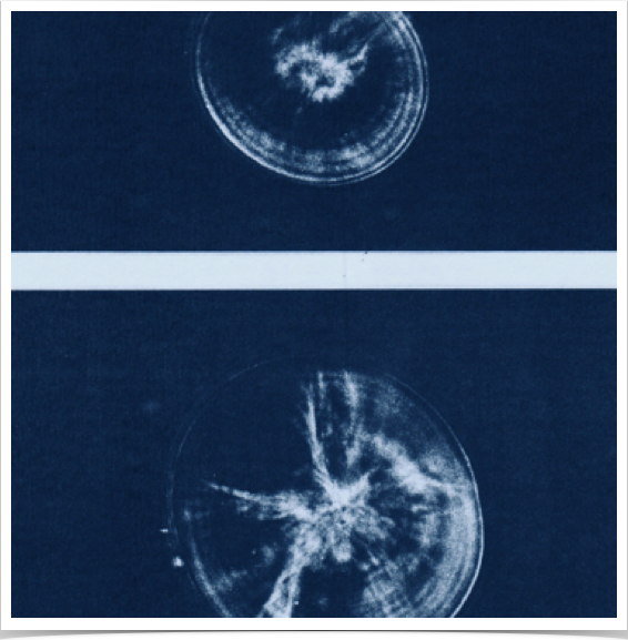 Sagittal otoliths of lab-reared sprat larvae. 11-day old on top with five rings, bottom sagitta of 17-day old larvae with 11 rings.