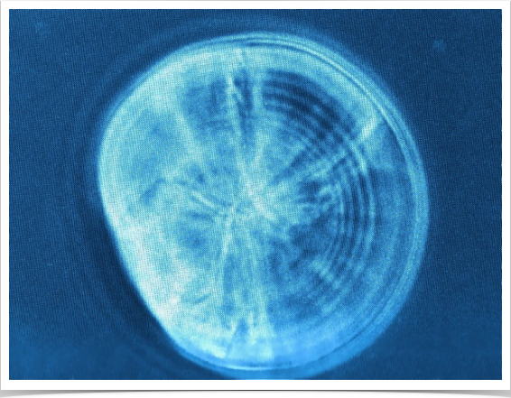 Sagitta otolith of a 18-day old laboratory-reared sprat larva. 12 increments are visible (1,000x magnification w/phase contrast)