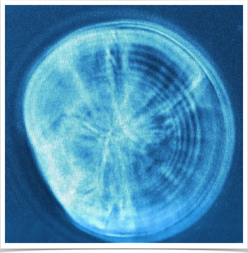 Sagitta otolith of a 18-day old laboratory-reared sprat larva. 12 increments are visible (1,000x magnification w/phase contrast)